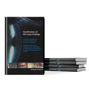Classification of Slit Lamp Findings